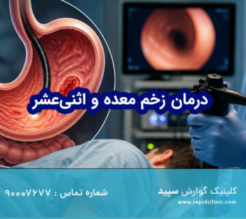درمان زخم معده و اثنی‌عشر با آندوسکوپی