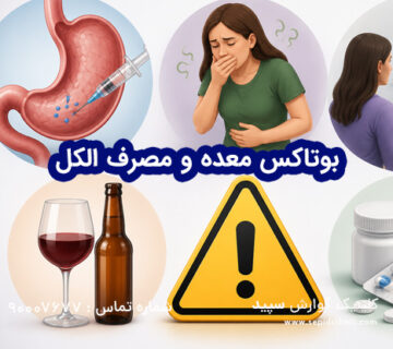 بوتاکس معده و مصرف الکل