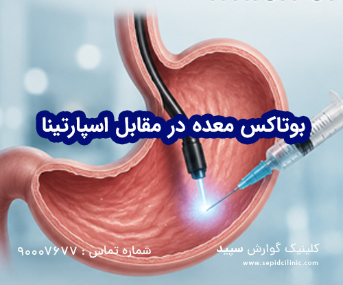 بوتاکس معده در مقابل اسپارتینا