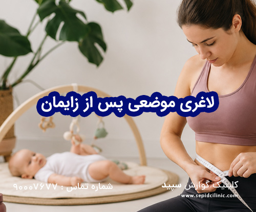 لاغری موضعی شکم بعد از زایمان