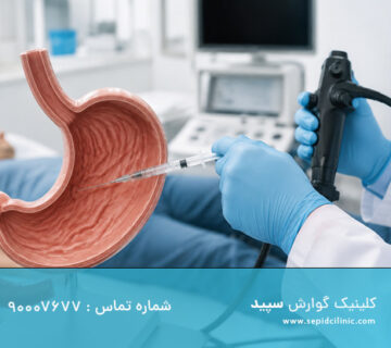 تزریق دوم بوتاکس معده