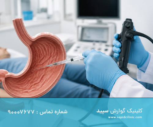 تزریق دوم بوتاکس معده