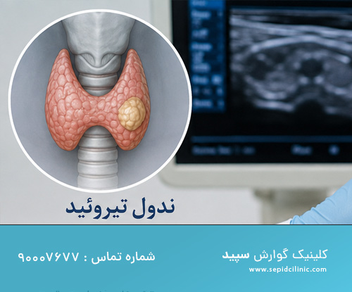 درمان غیرجراحی ندولهای مشکوک تیروئید