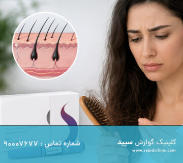 اسپارتینا و ریزش مو
