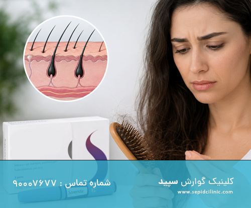 اسپارتینا و ریزش مو