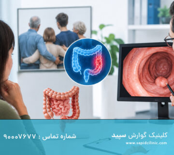 کولونوسکوپی با سابقه خانوادگی سرطان روده