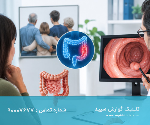 کولونوسکوپی با سابقه خانوادگی سرطان روده