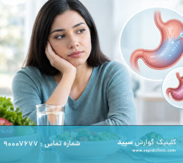 بازگشت اشتها بعد از بوتاکس معده