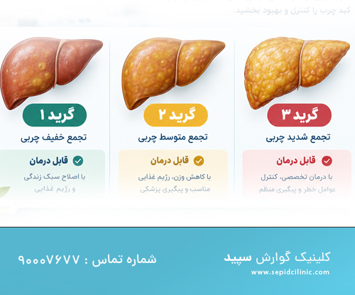 کبد چرب در چه گریدی قابل درمان است؟