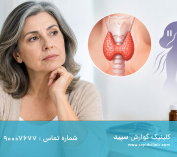 کم‌کاری تیروئید در دوران یائسگی