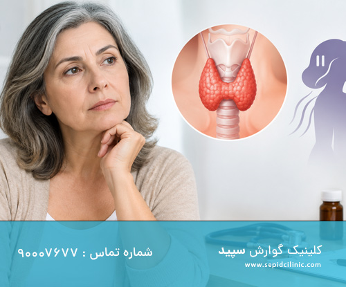 کمکاری تیروئید در دوران یائسگی