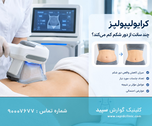 کرایولیپولیز برای لاغری موضعی