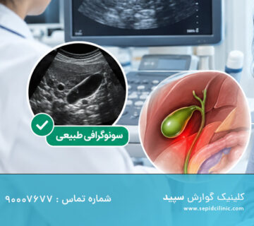 درد کیسه صفرا با سونوگرافی طبیعی
