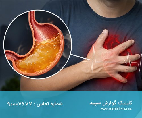 اختلالات ریتم قلبی و اسید معده