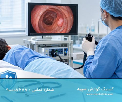 کولونوسکوپی برای تشخیص زودهنگام سرطان روده بزرگ با بیمه تکمیلی