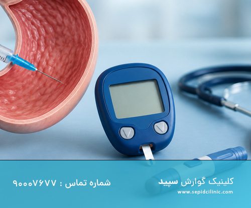 بوتاکس معده و کنترل قند خون