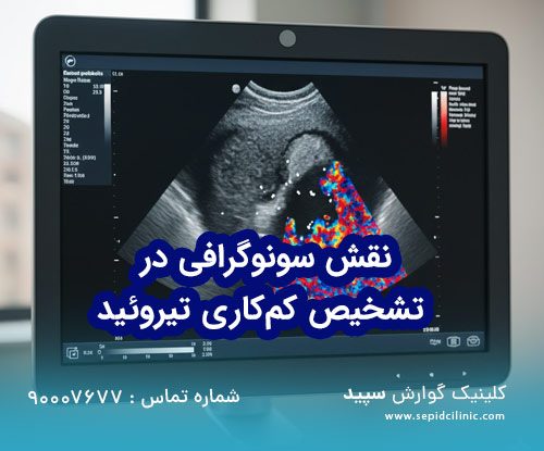 سونوگرافی برای تشخیص کم‌کاری تیروئید