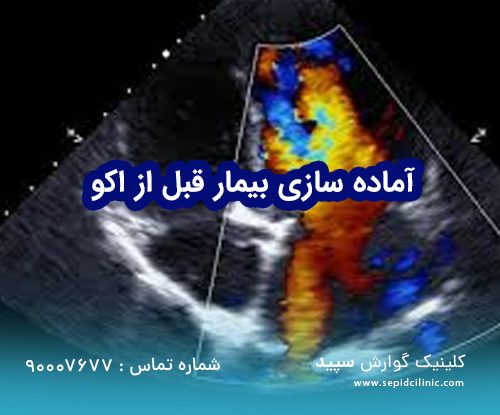 آماده‌سازی برای اکوکاردیوگرافی