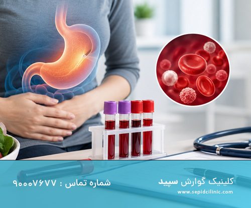 بوتاکس معده و کمبود آهن