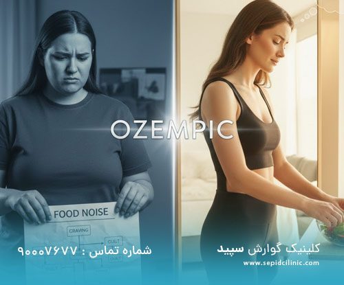 تاثیرات روانی اوزمپیک بر تصویر بدنی