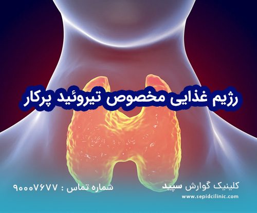 رژیم غذایی مخصوص