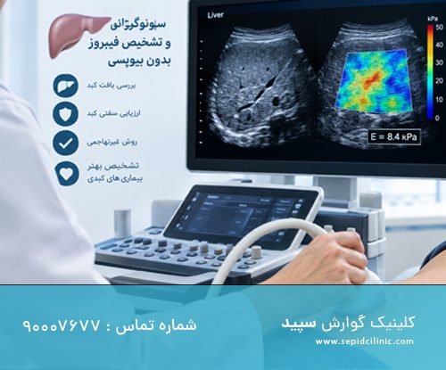 سونوگرافی کبد و تشخیص فیبروز