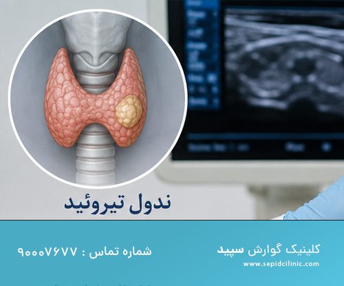 درمان غیرجراحی ندول‌های مشکوک تیروئید
