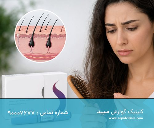 اسپارتینا و ریزش مو