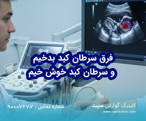 فرق سرطان کبد بدخیم و سرطان کبد خوش خیم