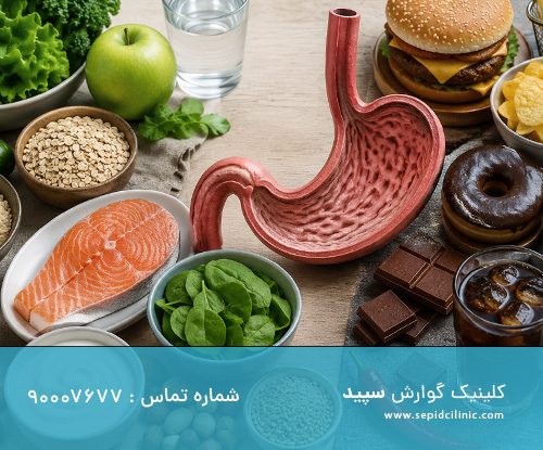 درمان فتق هیاتال بدون جراحی