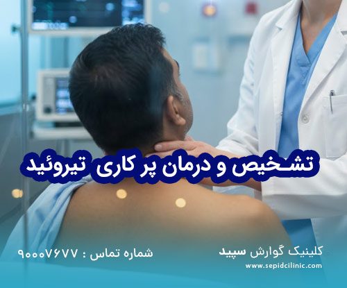 راهنمای جامع و تخصصی پرکاری تیروئید